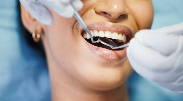 Best Urgent Care for Lost Fillings or Crowns in Brogden, NC